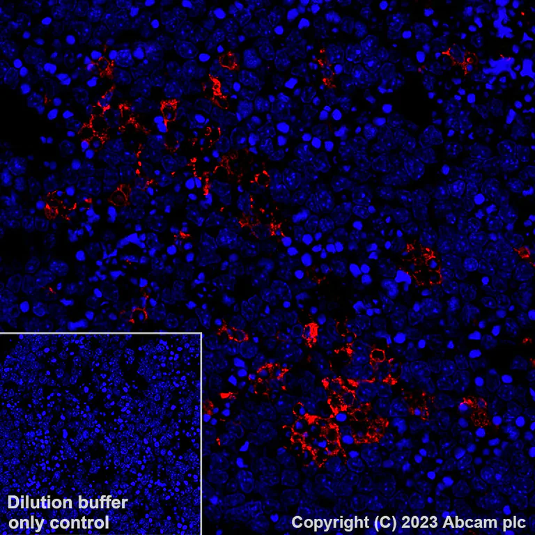 Immunohistochemistry (Formalin/PFA-fixed paraffin-embedded sections) - Alexa Fluor® 594 Anti-CD68 antibody [EPR23917-164] (AB312903)