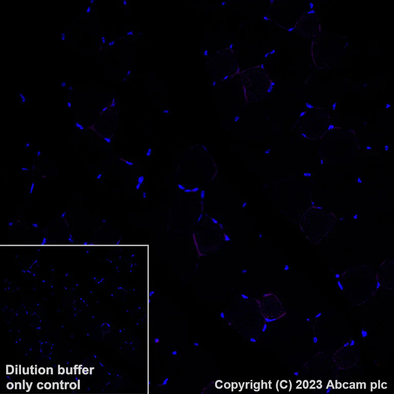 Immunohistochemistry (Formalin/PFA-fixed paraffin-embedded sections) - Alexa Fluor® 594 Anti-CD68 antibody [EPR23917-164] (AB312903)