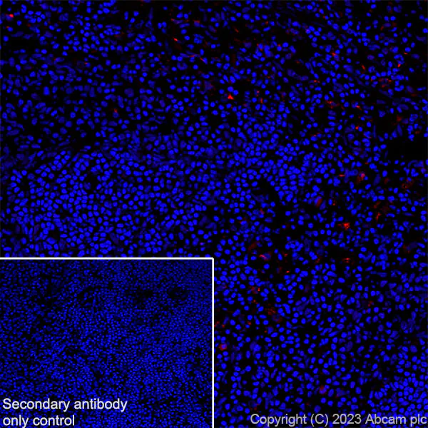 Immunohistochemistry (Frozen sections) - Alexa Fluor® 594 Anti-CD68 antibody [EPR23917-164] (AB312903)