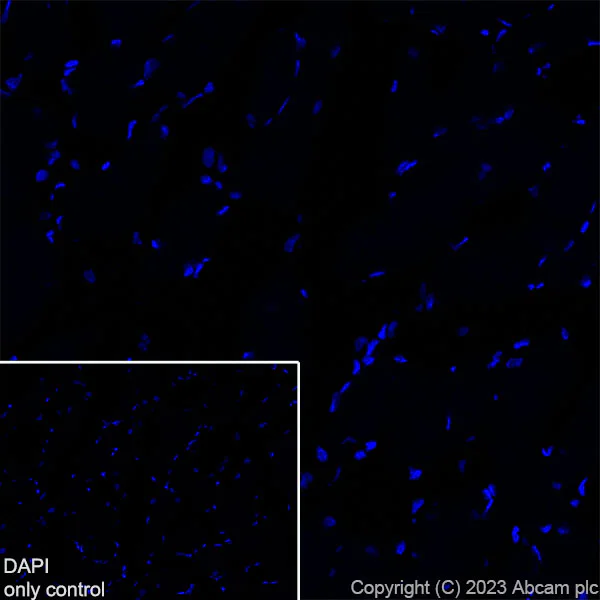 Immunohistochemistry (Frozen sections) - Alexa Fluor® 594 Anti-CD68 antibody [EPR23917-164] (AB312903)