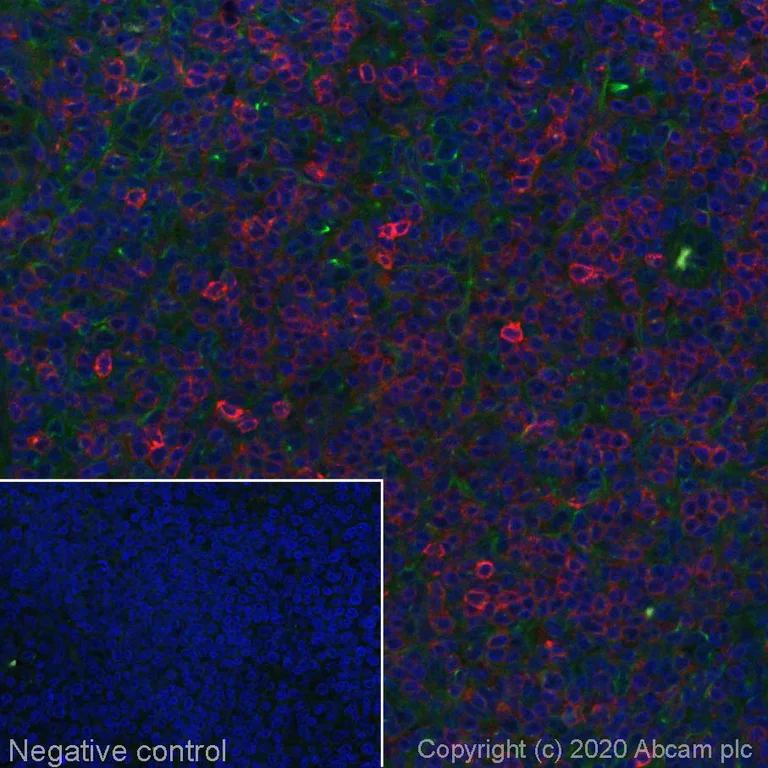 Immunohistochemistry (Formalin/PFA-fixed paraffin-embedded sections) - Alexa Fluor® 594 Anti-CD7 antibody [EPR4242] (AB277233)