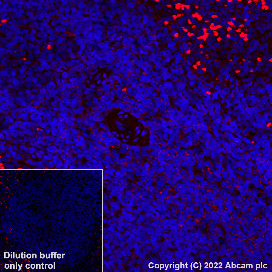 Immunohistochemistry (Formalin/PFA-fixed paraffin-embedded sections) - Alexa Fluor® 594 Anti-CD8 alpha antibody [CAL66] (AB305370), expandable thumbnail