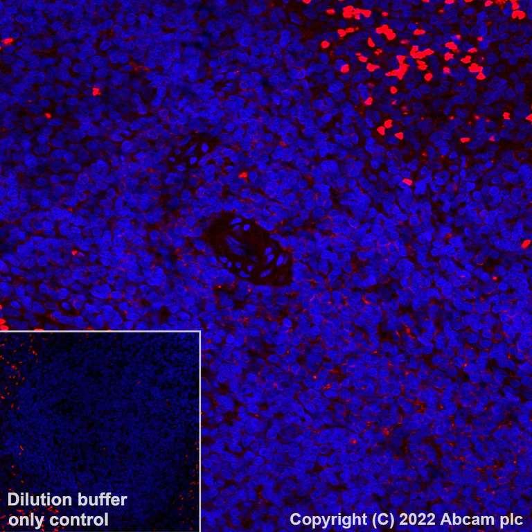 Immunohistochemistry (Formalin/PFA-fixed paraffin-embedded sections) - Alexa Fluor® 594 Anti-CD8 alpha antibody [CAL66] (AB305370)