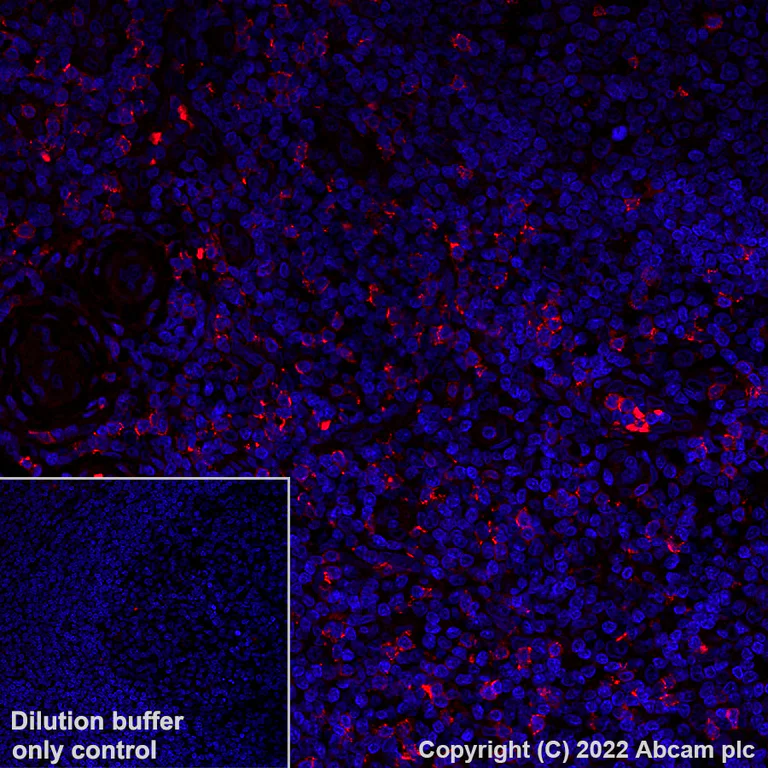 Immunohistochemistry (Formalin/PFA-fixed paraffin-embedded sections) - Alexa Fluor® 594 Anti-CD8 alpha antibody [CAL66] (AB305370)