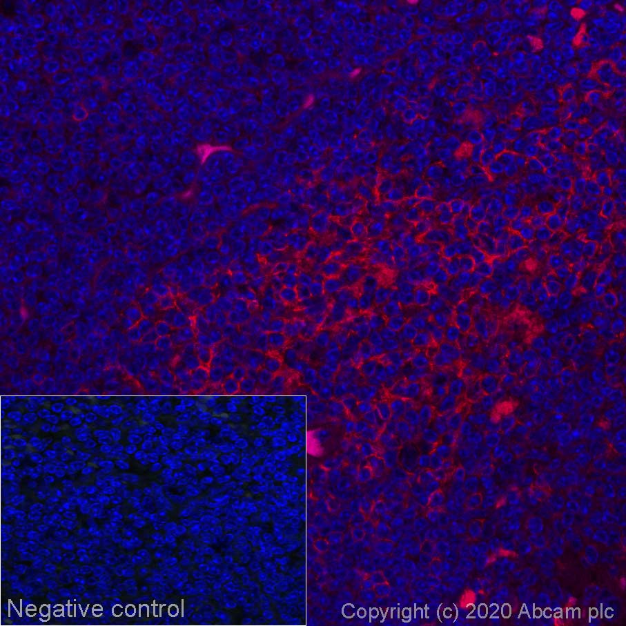 Immunohistochemistry (Formalin/PFA-fixed paraffin-embedded sections) - Alexa Fluor® 594 Anti-CD8 alpha antibody [EPR21769] (AB277939), expandable thumbnail
