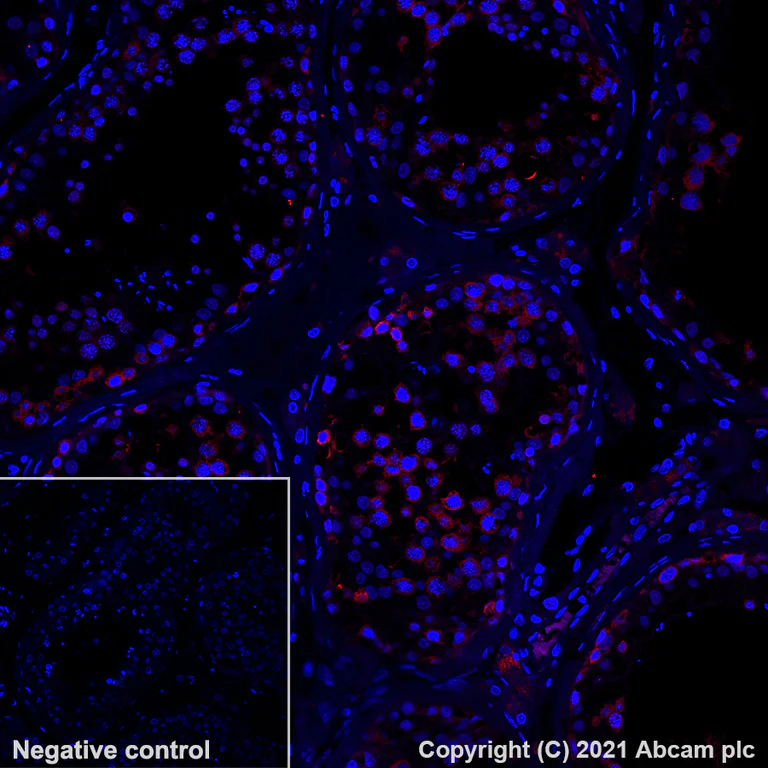 Immunohistochemistry (Formalin/PFA-fixed paraffin-embedded sections) - Alexa Fluor® 594 Anti-CTAG1B antibody [EPR13780] (AB282115)