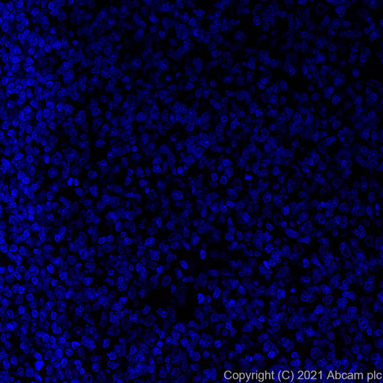 Immunohistochemistry (Formalin/PFA-fixed paraffin-embedded sections) - Alexa Fluor® 594 Anti-CTAG1B antibody [EPR13780] (AB282115)