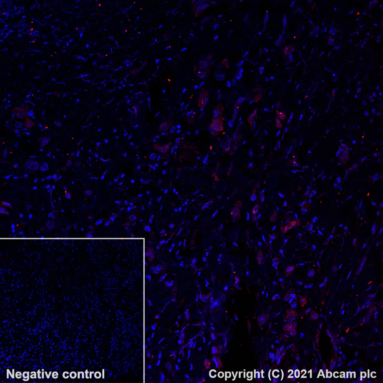 Immunohistochemistry (Formalin/PFA-fixed paraffin-embedded sections) - Alexa Fluor® 594 Anti-CTAG1B antibody [EPR13780] (AB282115)