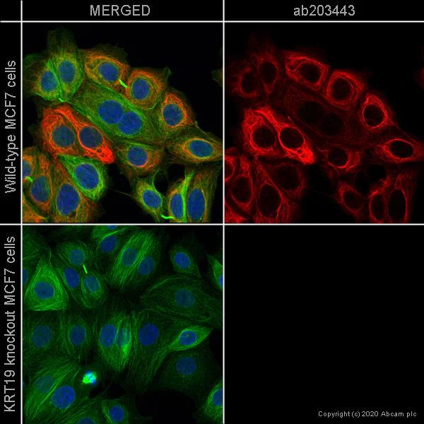 Immunocytochemistry/ Immunofluorescence - Alexa Fluor® 594 Anti-Cytokeratin 19 antibody [EP1580Y] (AB203443)