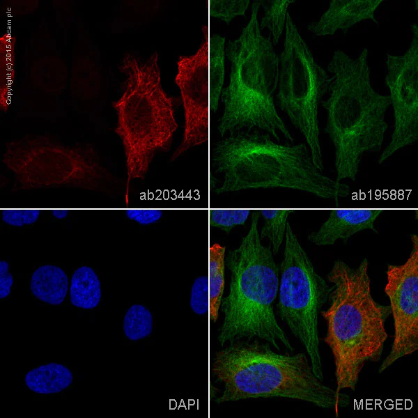 Immunocytochemistry/ Immunofluorescence - Alexa Fluor® 594 Anti-Cytokeratin 19 antibody [EP1580Y] (AB203443)