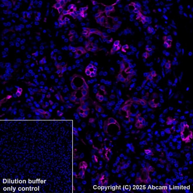 Anti-Cytokeratin 19 Alexa Fluor® 594 antibody [EP1580Y] (ab203443