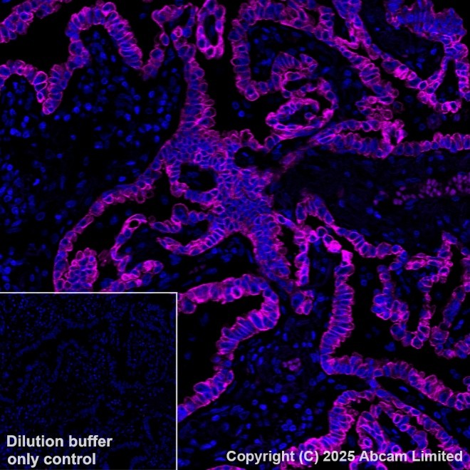 Anti-Cytokeratin 19 Alexa Fluor® 594 antibody [EP1580Y] (ab203443