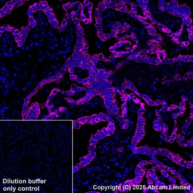 Anti-Cytokeratin 19 Alexa Fluor® 594 antibody [EP1580Y] (ab203443