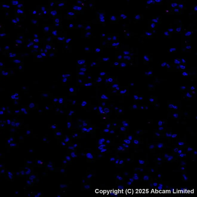 Immunohistochemistry paraffin embedded sections - Alexa Fluor® 594 Anti-Cytokeratin 19 antibody [EP1580Y] (AB203443)