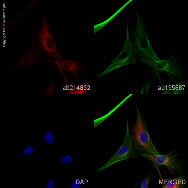 Immunocytochemistry/ Immunofluorescence - Alexa Fluor® 594 Anti-DARPP32 antibody [EP721Y] (AB214852)