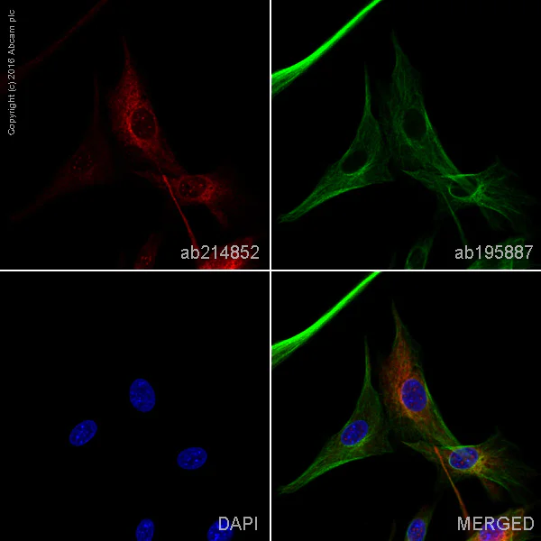 Immunocytochemistry/ Immunofluorescence - Alexa Fluor® 594 Anti-DARPP32 antibody [EP721Y] (AB214852)