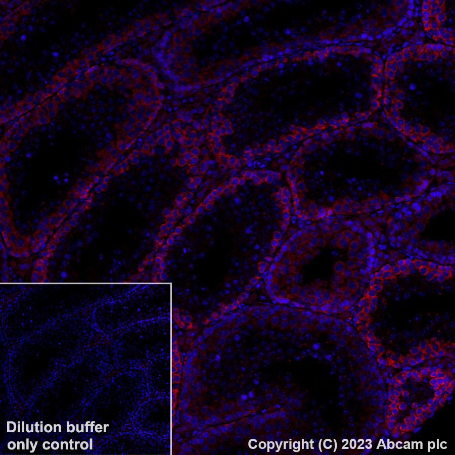 Immunohistochemistry (Formalin/PFA-fixed paraffin-embedded sections) - Alexa Fluor® 594 Anti-DAZL antibody [EPR21028] (AB314161), expandable thumbnail