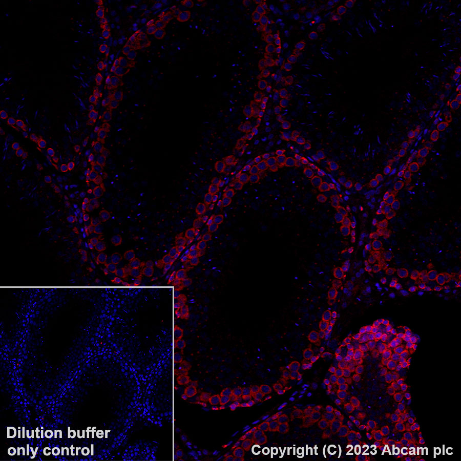 Immunohistochemistry (Formalin/PFA-fixed paraffin-embedded sections) - Alexa Fluor® 594 Anti-DAZL antibody [EPR21028] (AB314161), expandable thumbnail