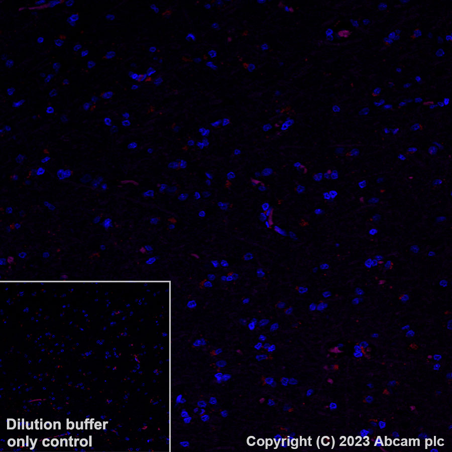 Immunohistochemistry (Formalin/PFA-fixed paraffin-embedded sections) - Alexa Fluor® 594 Anti-DAZL antibody [EPR21028] (AB314161), expandable thumbnail