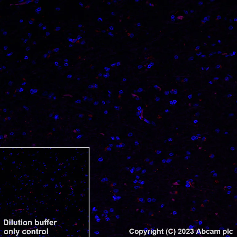 Immunohistochemistry (Formalin/PFA-fixed paraffin-embedded sections) - Alexa Fluor® 594 Anti-DAZL antibody [EPR21028] (AB314161)