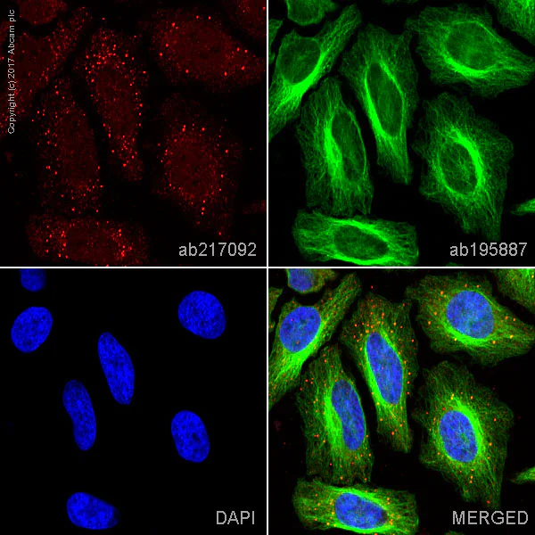 Immunocytochemistry/ Immunofluorescence - Alexa Fluor® 594 Anti-Dcp1a antibody [EPR13822] (AB217092)
