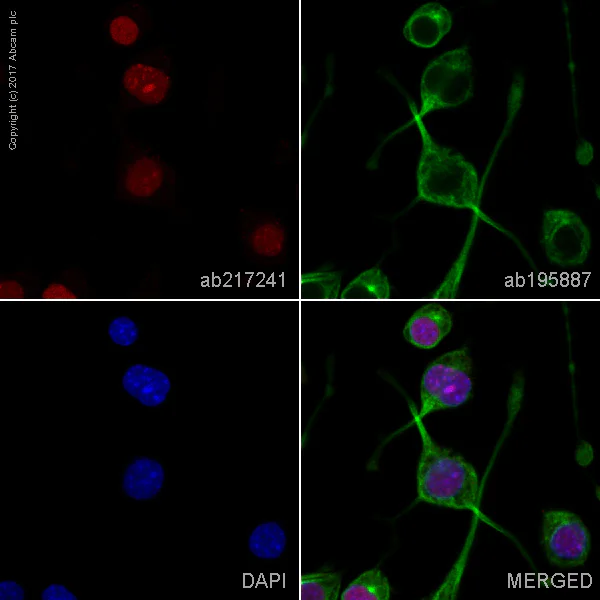 Immunocytochemistry/ Immunofluorescence - Alexa Fluor® 594 Anti-Dnmt1 antibody [EPR18453] (AB218290)