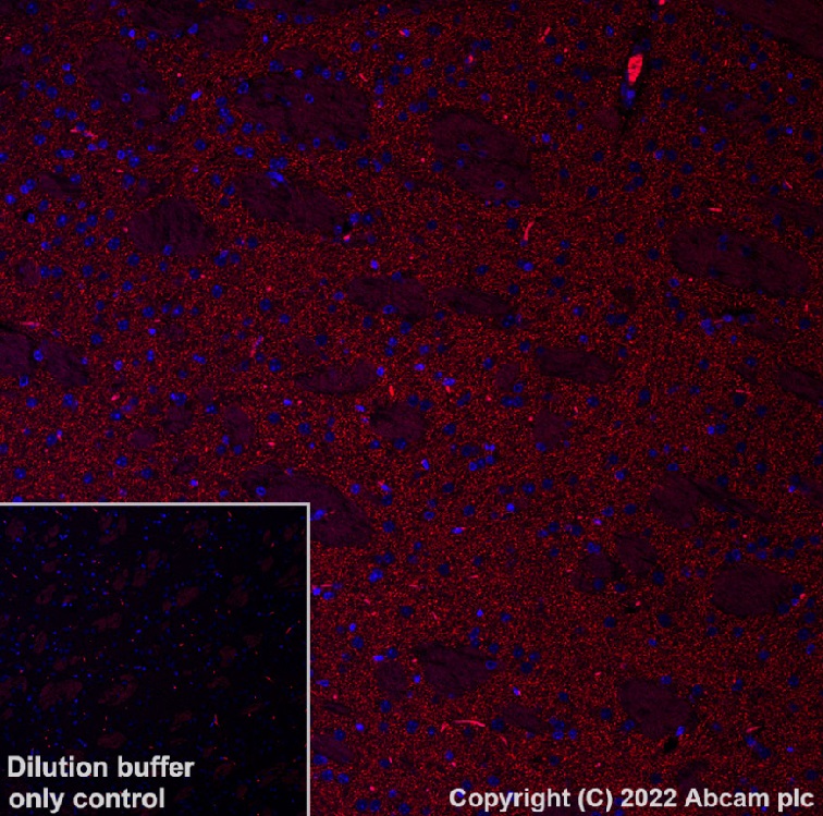 Immunohistochemistry (Formalin/PFA-fixed paraffin-embedded sections) - Alexa Fluor® 594 Anti-Dopamine Transporter antibody [EPR19695] (AB302834), expandable thumbnail