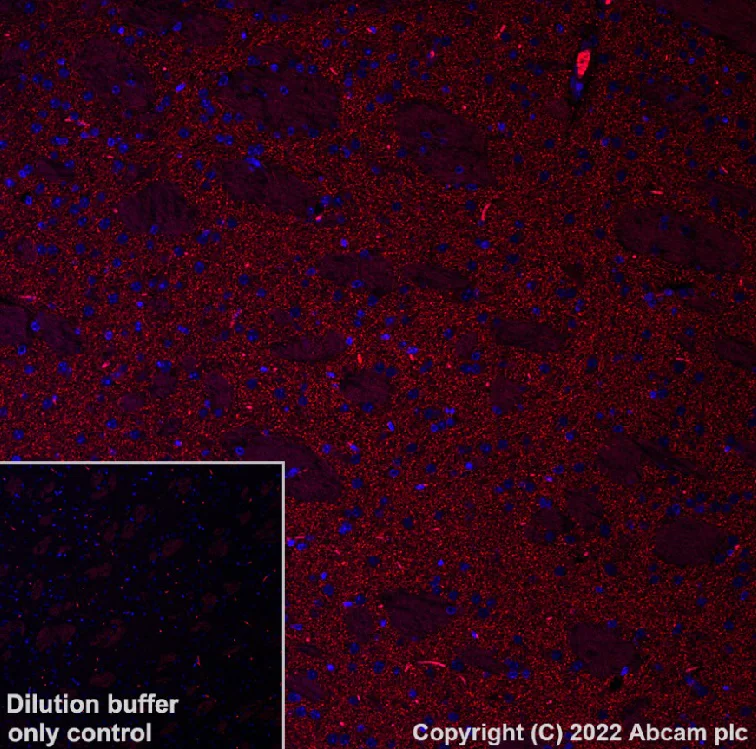 Immunohistochemistry (Formalin/PFA-fixed paraffin-embedded sections) - Alexa Fluor® 594 Anti-Dopamine Transporter antibody [EPR19695] (AB302834)