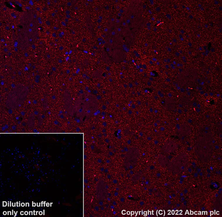 Immunohistochemistry (Formalin/PFA-fixed paraffin-embedded sections) - Alexa Fluor® 594 Anti-Dopamine Transporter antibody [EPR19695] (AB302834)