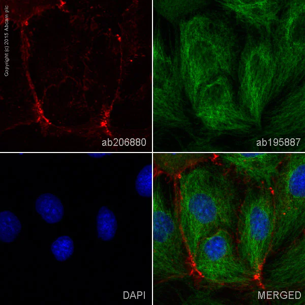 Immunocytochemistry/ Immunofluorescence - Alexa Fluor® 594 Anti-E Cadherin antibody [EP700Y] - Intercellular Junction Marker (AB206880)