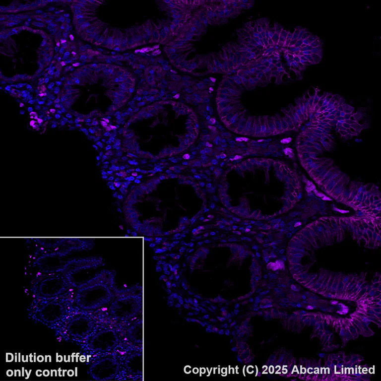 Immunohistochemistry (Formalin/PFA-fixed paraffin-embedded sections) - Alexa Fluor® 594 Anti-E Cadherin antibody [EP700Y] - Intercellular Junction Marker (AB206880)