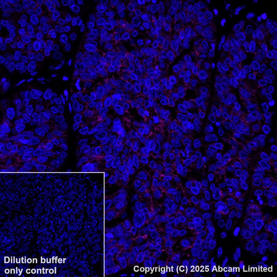 Alexa Fluor® 594 Anti-E Cadherin antibody [EP700Y] (ab206880) | Abcam
