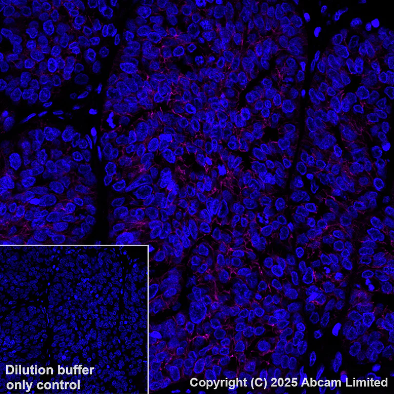 Immunohistochemistry (Formalin/PFA-fixed paraffin-embedded sections) - Alexa Fluor® 594 Anti-E Cadherin antibody [EP700Y] - Intercellular Junction Marker (AB206880)