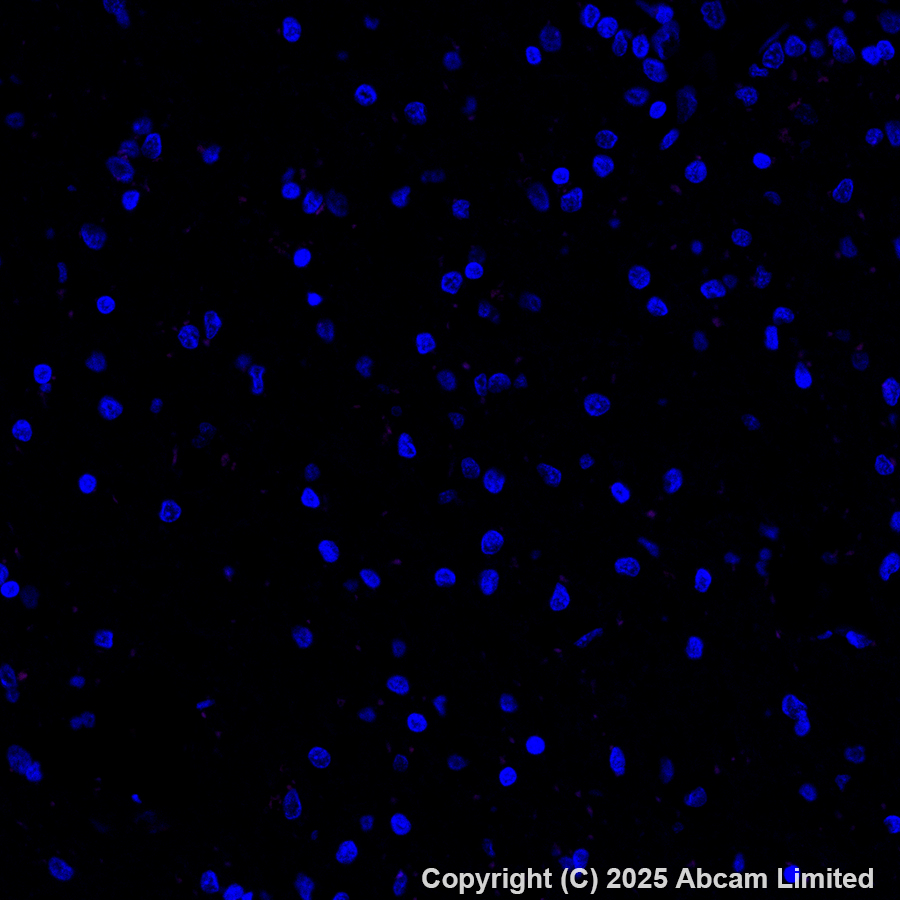 Immunohistochemistry (Formalin/PFA-fixed paraffin-embedded sections) - Alexa Fluor® 594 Anti-E Cadherin antibody [EP700Y] - Intercellular Junction Marker (AB206880)