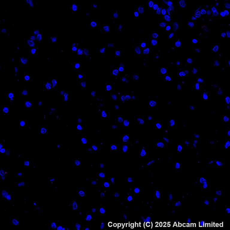 Immunohistochemistry (Formalin/PFA-fixed paraffin-embedded sections) - Alexa Fluor® 594 Anti-E Cadherin antibody [EP700Y] - Intercellular Junction Marker (AB206880)