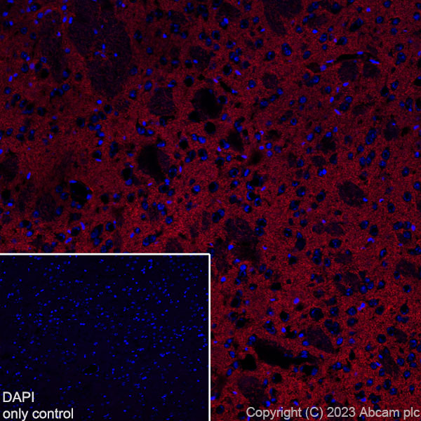 Immunohistochemistry (Frozen sections) - Alexa Fluor® 594 Anti-EAAT2 antibody [EPR19798] (AB313821), expandable thumbnail
