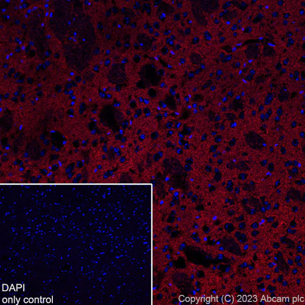 Immunohistochemistry (Frozen sections) - Alexa Fluor® 594 Anti-EAAT2 antibody [EPR19798] (AB313821)