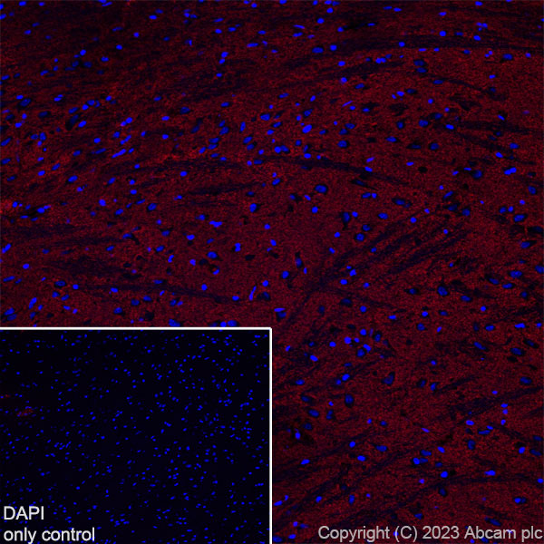 Immunohistochemistry (Frozen sections) - Alexa Fluor® 594 Anti-EAAT2 antibody [EPR19798] (AB313821), expandable thumbnail