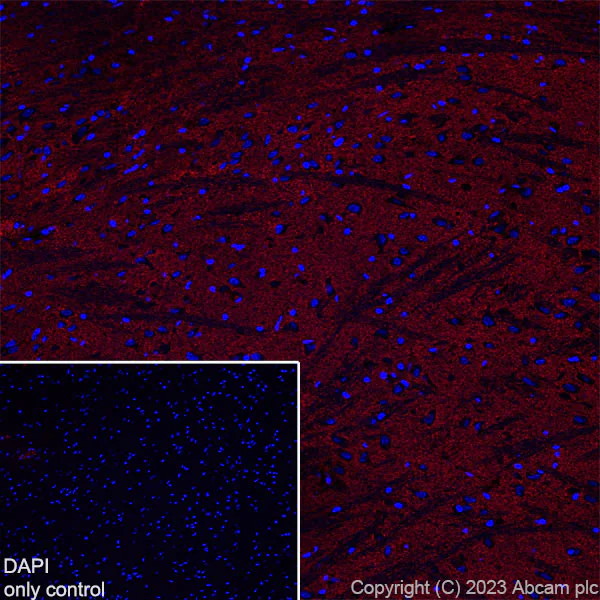 Immunohistochemistry (Frozen sections) - Alexa Fluor® 594 Anti-EAAT2 antibody [EPR19798] (AB313821)