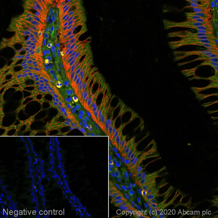 Immunohistochemistry (Formalin/PFA-fixed paraffin-embedded sections) - Alexa Fluor® 594 Anti-EpCAM antibody [EPR677(2)] (AB275345)