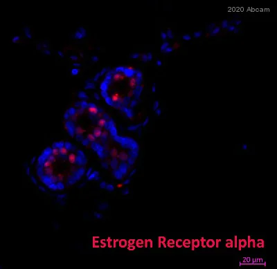 Immunohistochemistry (Formalin/PFA-fixed paraffin-embedded sections) - Alexa Fluor® 594 Anti-Estrogen Receptor alpha antibody [EPR4097] (AB207046)