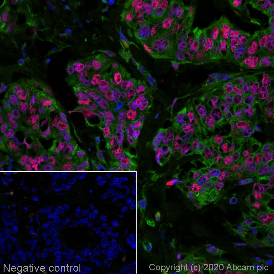 Immunohistochemistry (Formalin/PFA-fixed paraffin-embedded sections) - Alexa Fluor® 594 Anti-Estrogen Receptor alpha antibody [EPR4097] (AB207046)