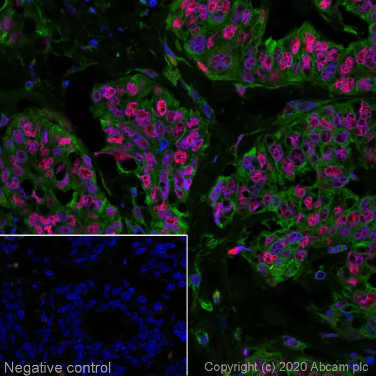 Immunohistochemistry (Formalin/PFA-fixed paraffin-embedded sections) - Alexa Fluor® 594 Anti-Estrogen Receptor alpha antibody [EPR4097] (AB207046)