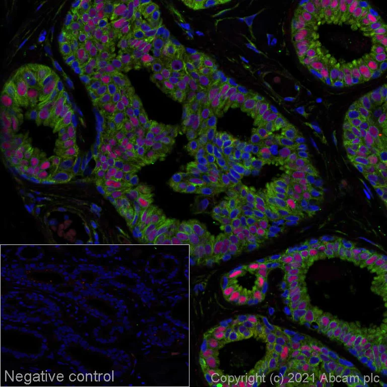 Immunohistochemistry (Formalin/PFA-fixed paraffin-embedded sections) - Alexa Fluor® 594 Anti-Estrogen Receptor alpha antibody [SP1] (AB282651)