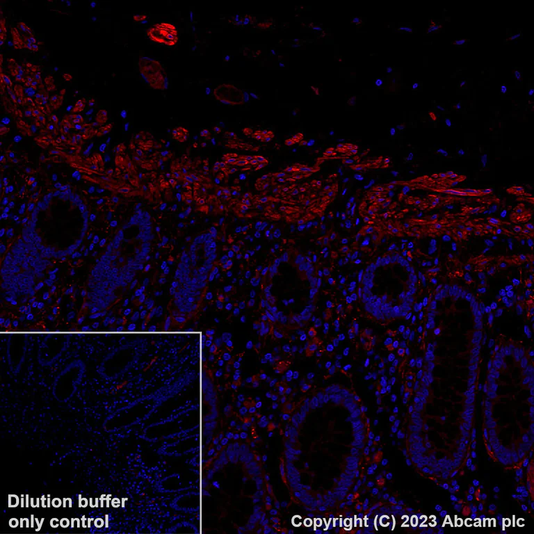 Immunohistochemistry (Formalin/PFA-fixed paraffin-embedded sections) - Alexa Fluor® 594 Anti-Fibronectin antibody [EPR23110-46] (AB309604)