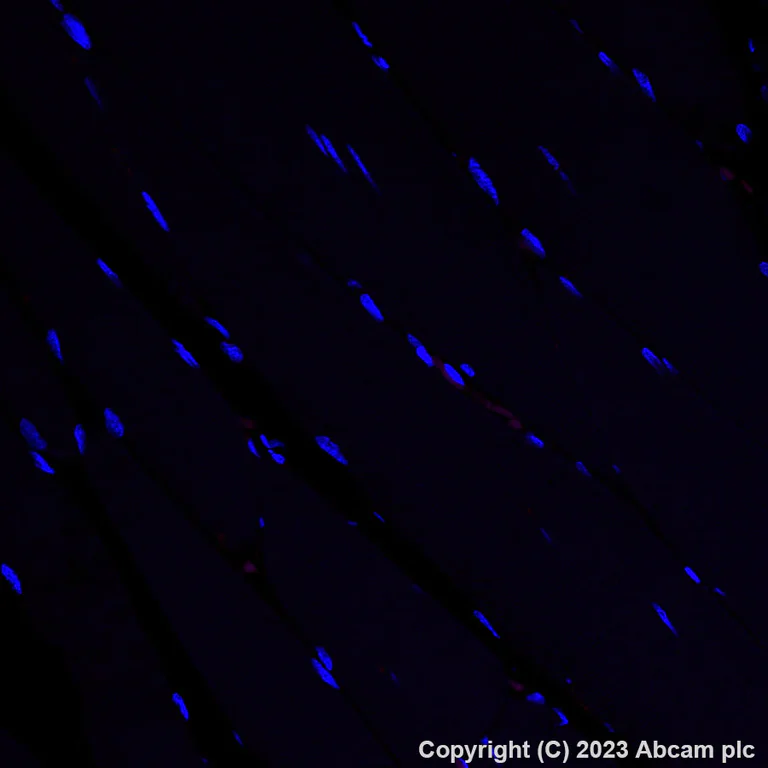 Immunohistochemistry (Formalin/PFA-fixed paraffin-embedded sections) - Alexa Fluor® 594 Anti-Fibronectin antibody [EPR23110-46] (AB309604)