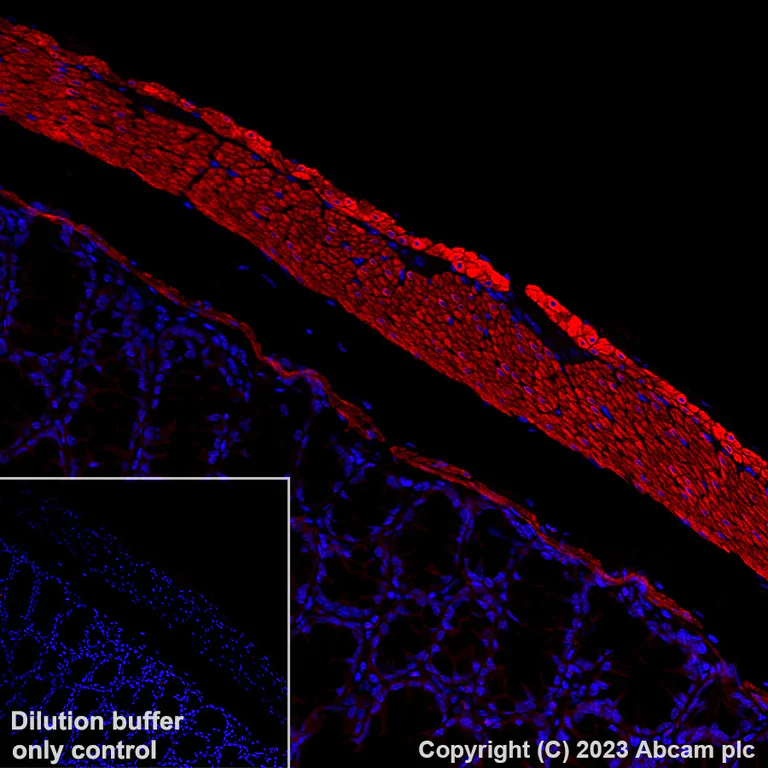 Immunohistochemistry (Formalin/PFA-fixed paraffin-embedded sections) - Alexa Fluor® 594 Anti-Fibronectin antibody [EPR23110-46] (AB309604)