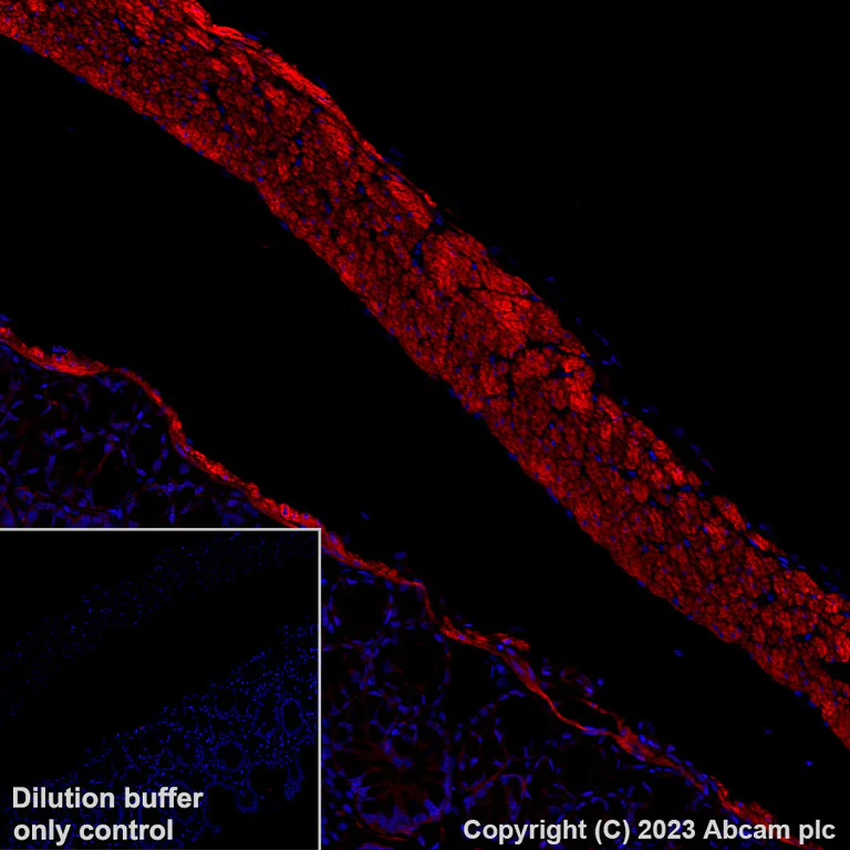 Immunohistochemistry (Formalin/PFA-fixed paraffin-embedded sections) - Alexa Fluor® 594 Anti-Fibronectin antibody [EPR23110-46] (AB309604)