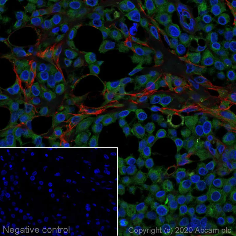 Immunohistochemistry (Formalin/PFA-fixed paraffin-embedded sections) - Alexa Fluor® 594 Anti-Fibronectin antibody [F1] (AB275336)