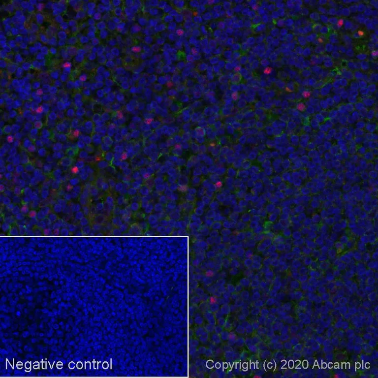 Immunohistochemistry (Formalin/PFA-fixed paraffin-embedded sections) - Alexa Fluor® 594 Anti-FOXP3 antibody [SP97] (AB275080)